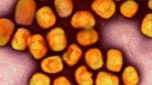 variole-du-singe-monkeypox